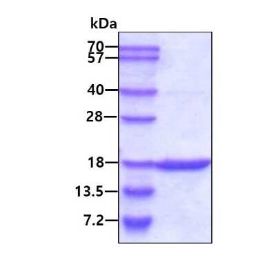 SDS-PAGE: Recombinant Human GMFG Protein [NBC1-19063]